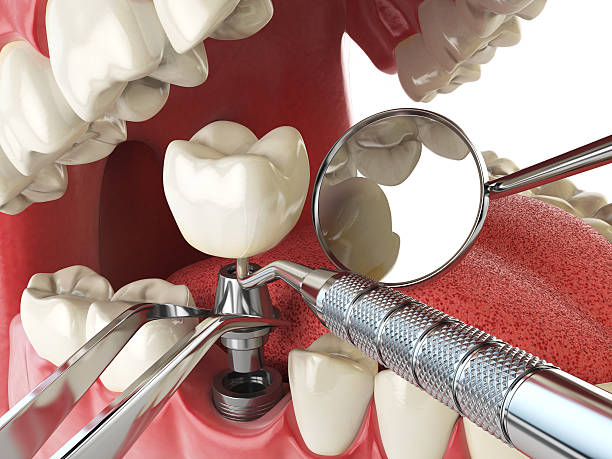 Best Emergency Treatment for Toothache in Mcadenville, NC